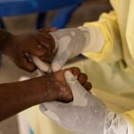 Mpox in Africa prompts $500 million funding from Gavi for vaccines