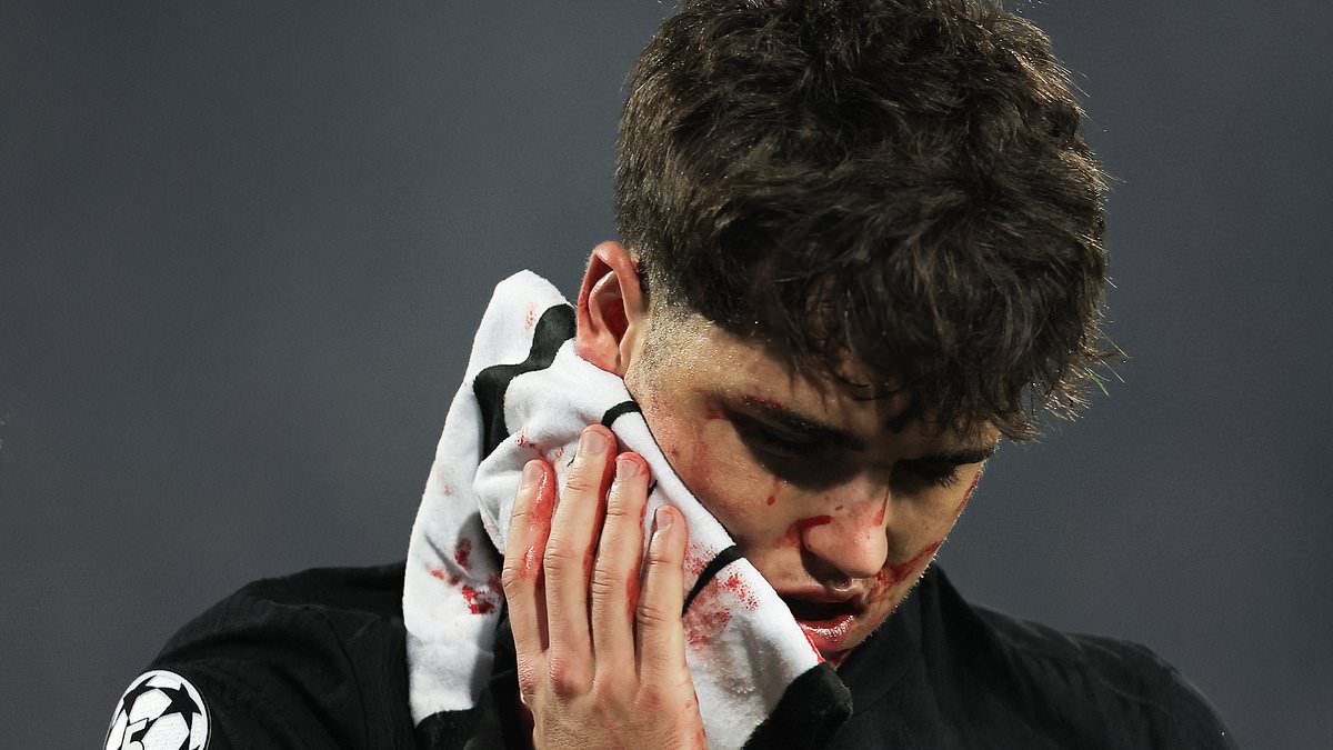 Pau Cubarsi : Blessure Choquante lors de la Victoire de Barcelone