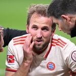 Harry Kane victime d-un choc lors du match Bayern-Leverkusen